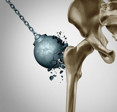 Cauze ce pot destabiliza osul - Osteoporoza